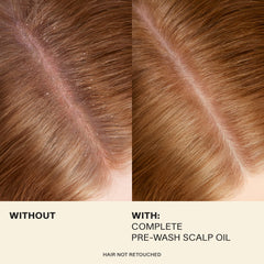 Rosemary extract visual highlights improved scalp circulation for healthier roots