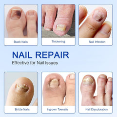 Jynivo nail patches overnight application demonstrates secure wear