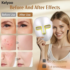 Kelyoo LED face mask worn on model to show comfortable fit