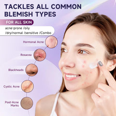 Kempc hyaluronic-acid-soothing-cream-application provides hydration and calm for sensitive skin.
