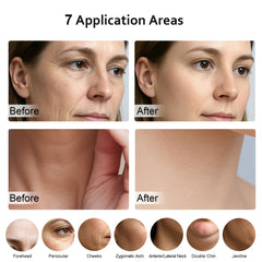 Keylitos massager in use with easy glide for daily skin routine