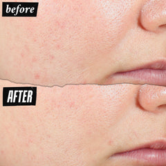Kiehl's Expertly Clear close look at Salicylic Acid 1.2% for pore-clearing action.