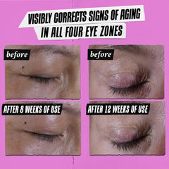 Kiehl's Super Multi-Corrective Eye Cream bilberry seed extract smoothing around eyes.