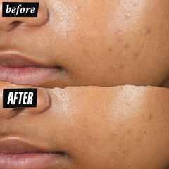 Kiehl's patch-bottle-dispense image pairs the product with precise application.