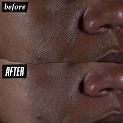 Kiehl's Ultra Pure serum on skin showing refined texture and pores.
