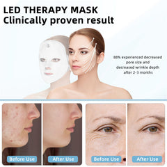 KNNKNN red light mask neck and chin focus for smoother appearance