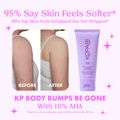 Kopari KP Body Bumps Be Gone with glycolic and lactic acids for renewed clarity