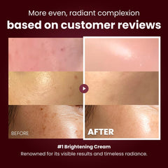 Kopher Curepair Mela Cream pump close-up demonstrates easy, controlled application.