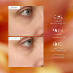KORA Organics Turmeric Glow Drops hyaluronic acid reveal hydrated, pore-minimized skin.