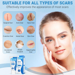 Kunyle scar gel texture close up shows non greasy, lightweight formula.