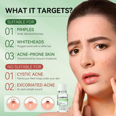 LANBENA acne spot serum texture closeup highlighting lightweight, fast-absorbing formula.