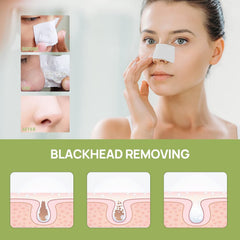 LANBENA Blackhead Remover mask application on skin reduces shine while cleansing pores.