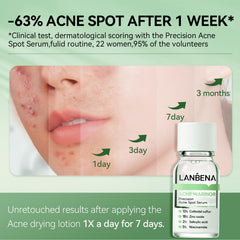 LANBENA night-time pimple treatment on the face demonstrates targeted acne care.