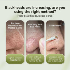 LANBENA nose strips pack open highlighting purifying strips for deep cleanse.