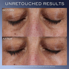Lancôme Génifique Eye Cream application swatch shows hydrating formula for delicate under-eye skin.