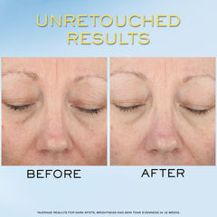 Lancôme Niacinamide Vitamin Cg Hyaluronic Acid ingredient graphics.