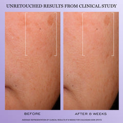 Lancôme Rénergie H.C.F. vitamin C chamber brightens the complexion.
