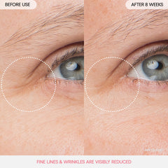 LANEIGE Peony & Collagen Complex visual focus promotes firmer-looking under-eye skin