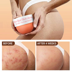 LA.PERSONAL butt acne cream quick absorption texture