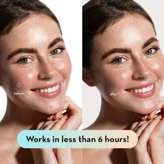 LE GUSHE invisible patch on skin blends with makeup