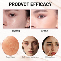 Lingyun full-coverage concealer tackles blemishes for even tone