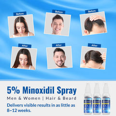 Listarfe 5% Minoxidil for men's hair growth on thinning crown areas.