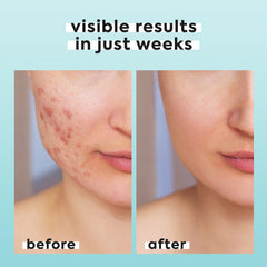 LivaClean travel-size HOCl spray for on-the-go refresh and quick revitalization.