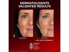 Vitamin C feature image signals brightening potential of Revitalift Triple Power moisturizer.