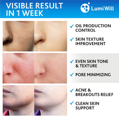 LumiWill pad infused with vitamins C and E for brightening and protection