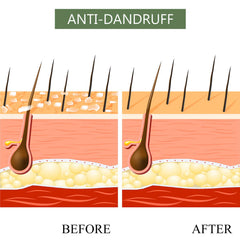 Luseta Tea Tree & Argan Oil detangling set packaging highlights sulfate-free, cruelty-free formula