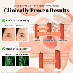 Madeca Derma hyaluronic acid hydration droplets on skin for plump moisture.