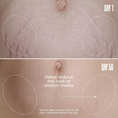 MAËLYS B-FLAT application demonstrates circular massage for smoother belly skin.