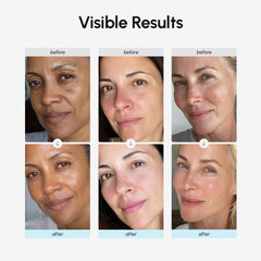MAREE collagen hyaluronic acid ingredients label emphasizes skin hydration and renewal potential.