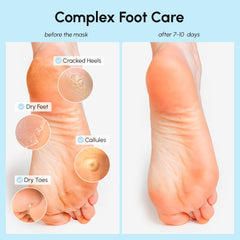 MAREE Foot Peeling Mask close-up reveals glycolic-acid exfoliation for softer skin.