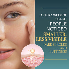 Matykos under-eye patches on skin with hyaluronic acid for refreshed under-eye area.