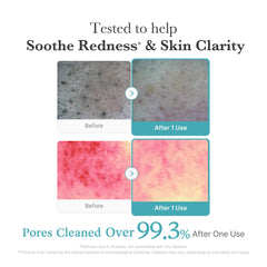 medicube Azelaic Acid Gummy Whip Cleanser niacinamide glow close-up hints balanced skin tone for daily care
