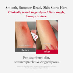 Medicube Red Body Peeling Shot spray on shoulders and chest for smoother skin