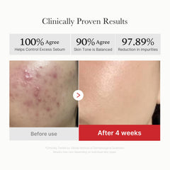 Medicube Red Succinic Pad swatch highlights BHA and AHA ingredients.