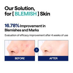 Mediheal Madecassoside Blemish Pad being swiped across skin for quick blemish care.