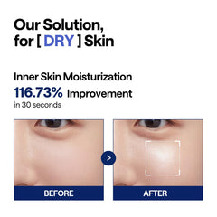 Mediheal Watermide Pad Icelandic water drop signals refreshing hydration.