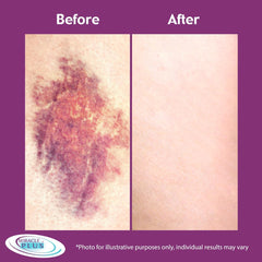 Miracle Plus Arnica Cream closeup emphasizes hydration and care for distressed skin