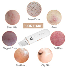 MISERWE Skin Scrubber metal head closeup highlighting durable stainless steel surface