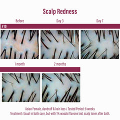 Moist Diane wasabi japonica scalp care image supports balanced scalp.