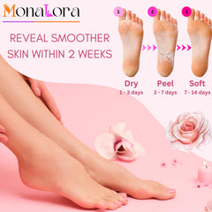 MonaLora Foot Peel Mask booties worn on feet during treatment