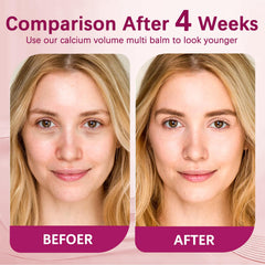 MQN calcium-stick neck hydration and subtle firmness feel