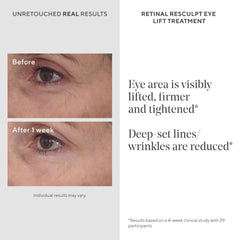 Creamy texture and encapsulated retinal detail in Murad formula