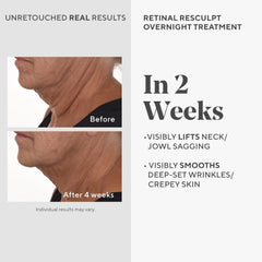 Murad Retinal ReSculpt pump bottle ready for nightly application improving texture