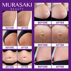 Murasaki Beauty hyaluronic acid close-up highlights deep hydration for skin resilience.