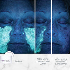 NassifMD Exfoliating Detox Pads closeup texture reveals micro-exfoliation for smoother skin