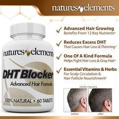 Natures Elements DHT Blocker bottle label highlights vegetarian, clean formula